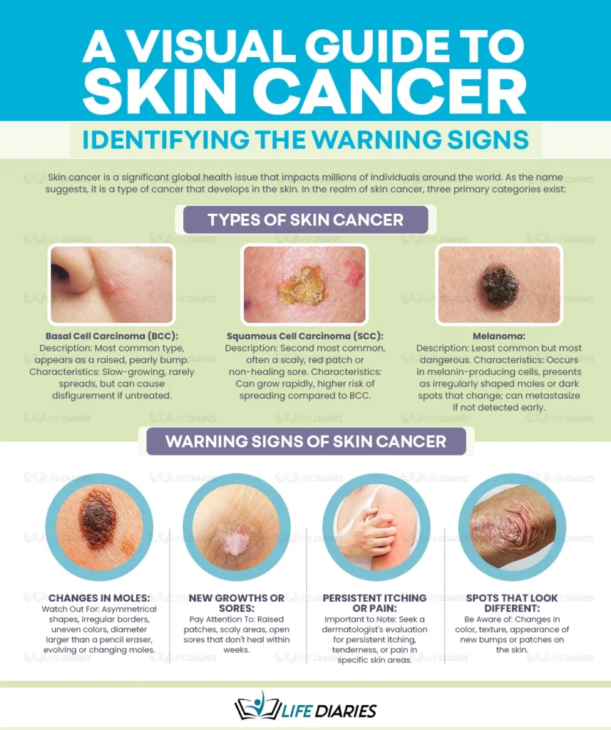 Infographic skin cancer